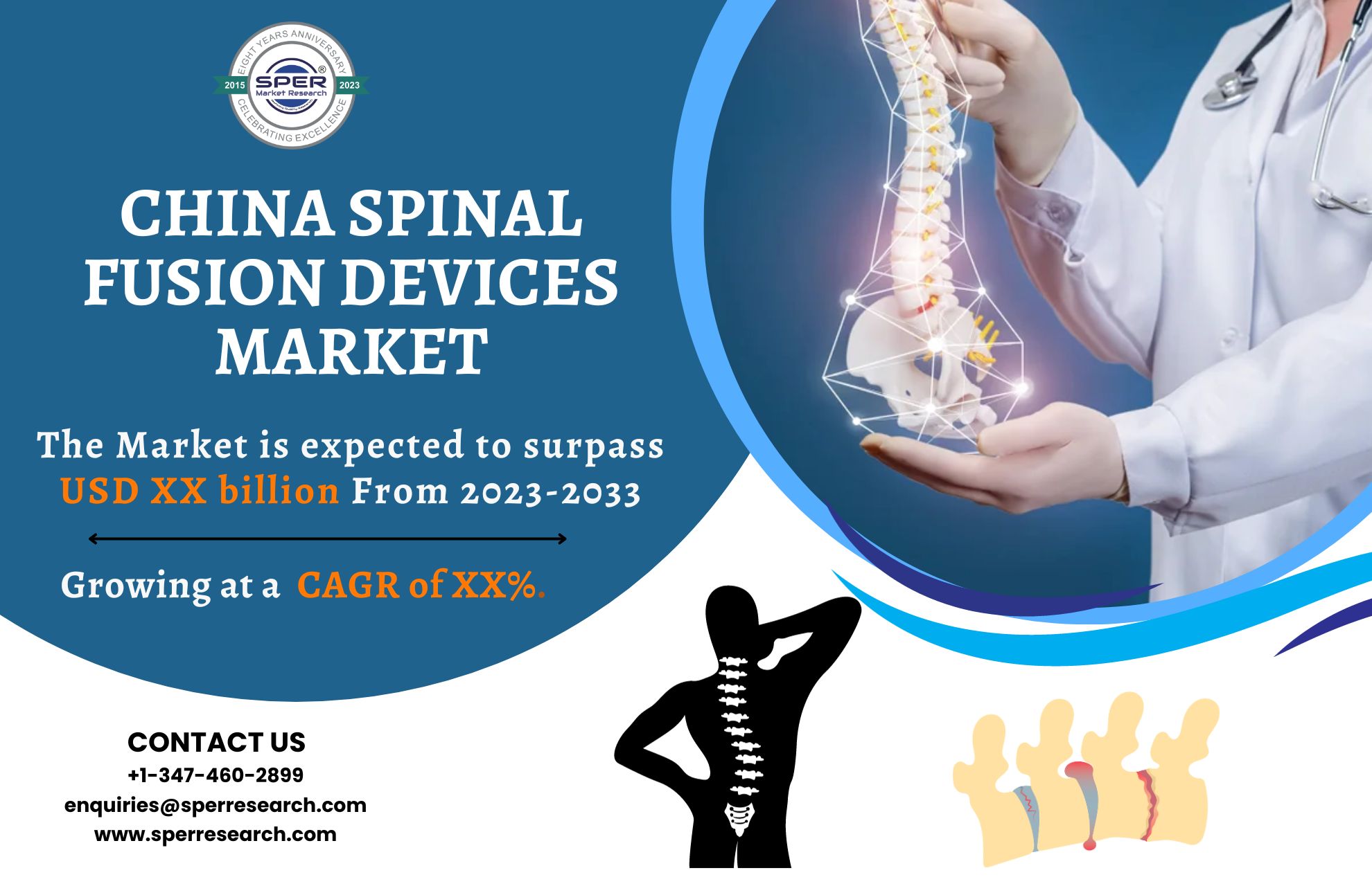 China Spinal Fusion Market Share 2023- Industry Trends, Revenue, Growth Drivers, CAGR Status, Business Opportunities and Future Competition till 2033: SPER Market Research