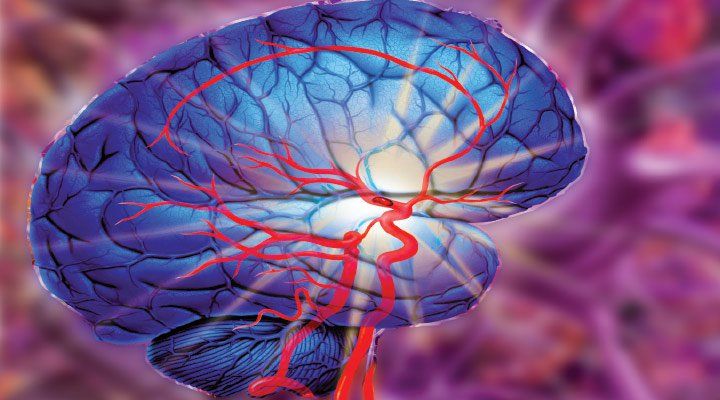Acute Ischemic Stroke (AIS) is Estimated to Witness High Growth Owing to Availability of Novel Therapies
