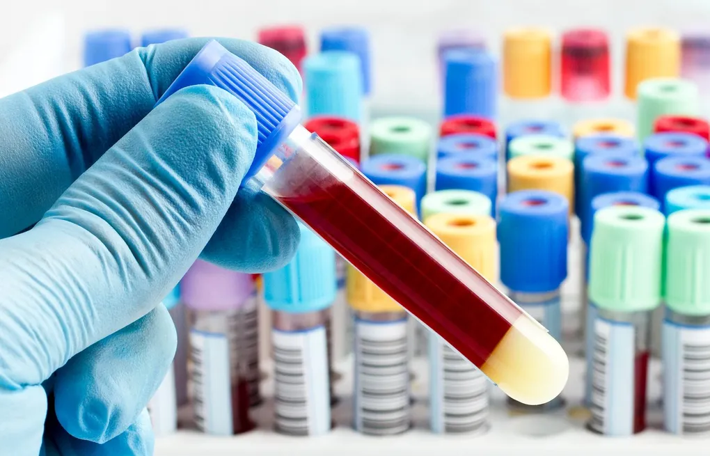 Blood Plasma Derivatives Market Poised to Display Robust Growth Due to High Demand for Therapeutic Proteins