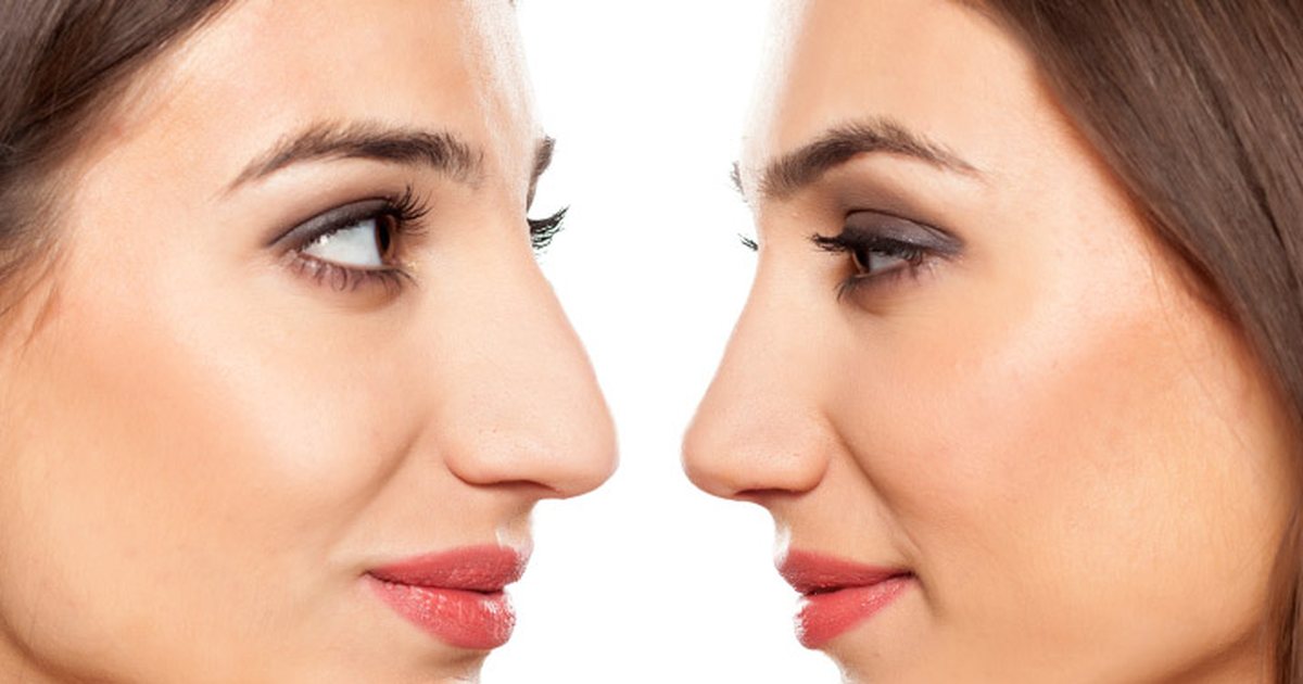 The Global Rhinoplasty Market Growth Accelerated By Rising Demand For Cosmetic Procedures