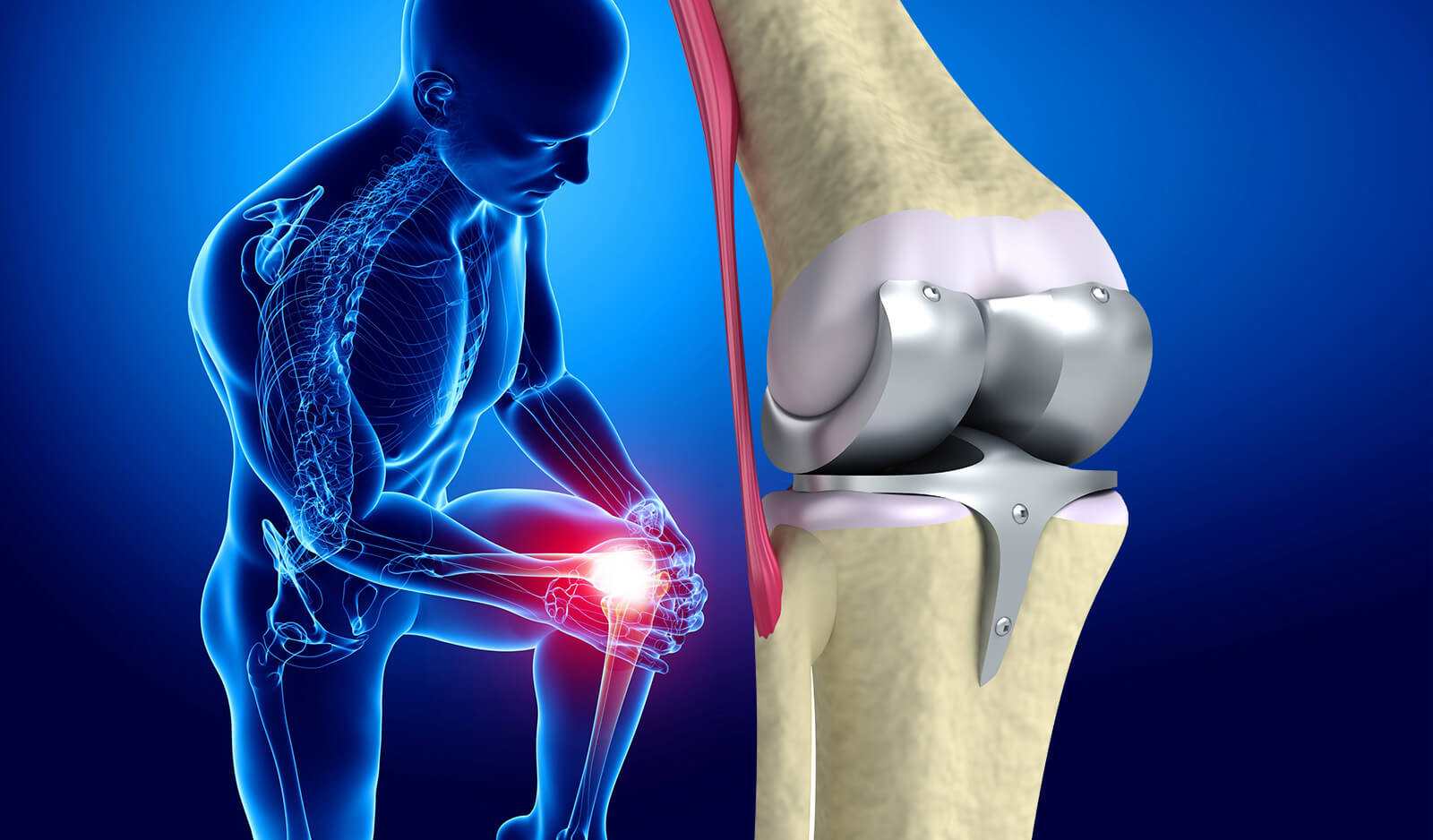 Total Knee Arthroplasty Market is Expected to be Flourished by Increasing Sports Injuries