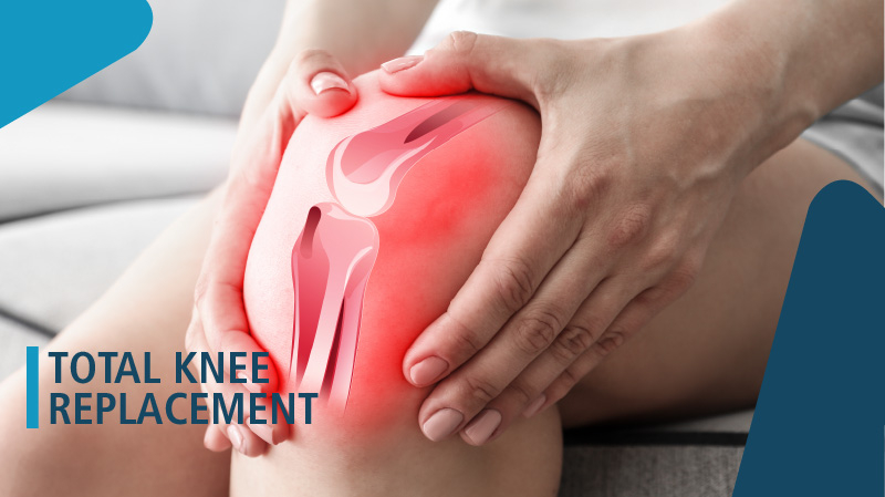 Understanding the Benefits and Risks of Total Knee Replacement Surgery