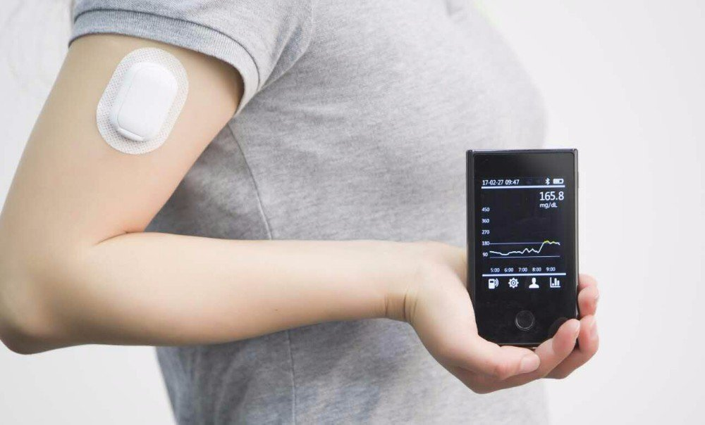 Glucose Monitoring Devices Market Size, share & Forecast to 2033
